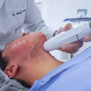cliniderma, reduccion de papada